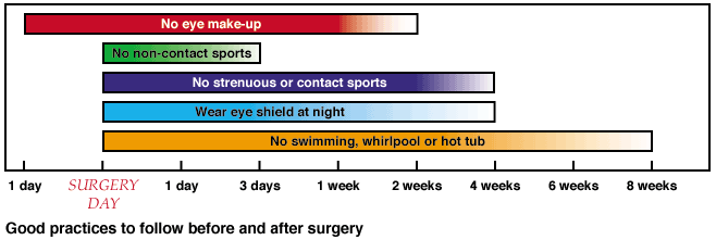 LASIK good practices chart