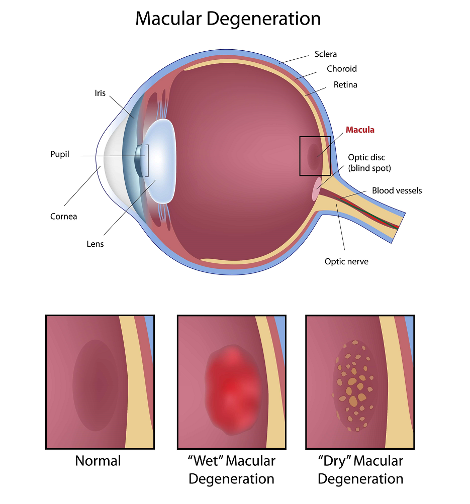 Macular degeneration information