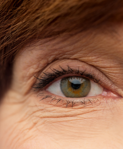 Image representing cosmetic eye procedures.