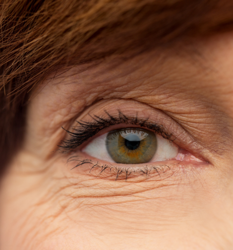Cosmetic Eye Procedures